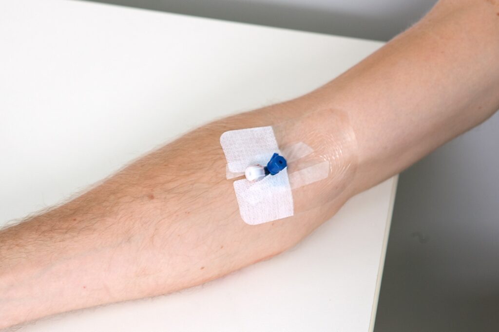 Cannula Insertion at Home in Gurgaon
