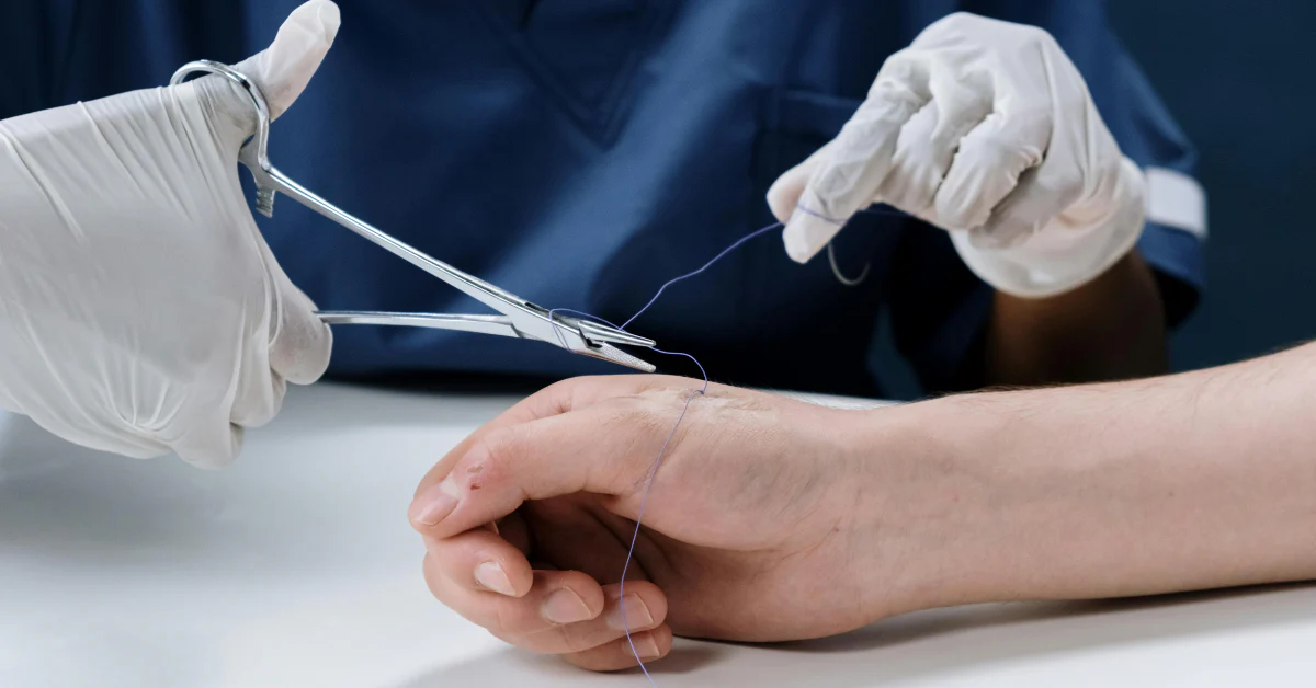 Suture Removal at Home 1 suture-removal-at-home-in-gurgaon