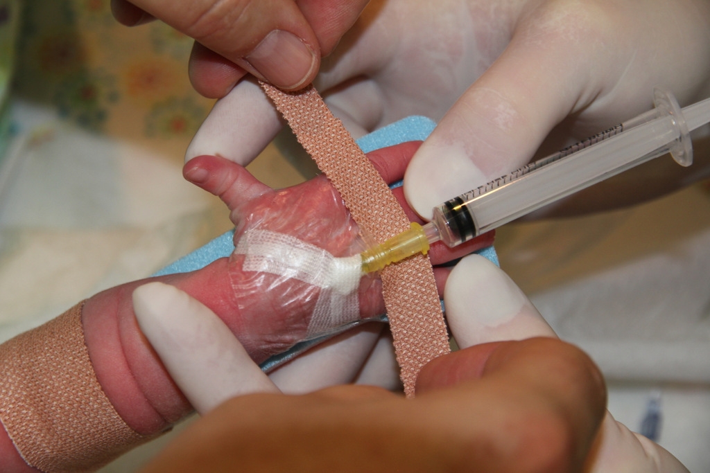 Cannula Insertion at Home in Gurgaon