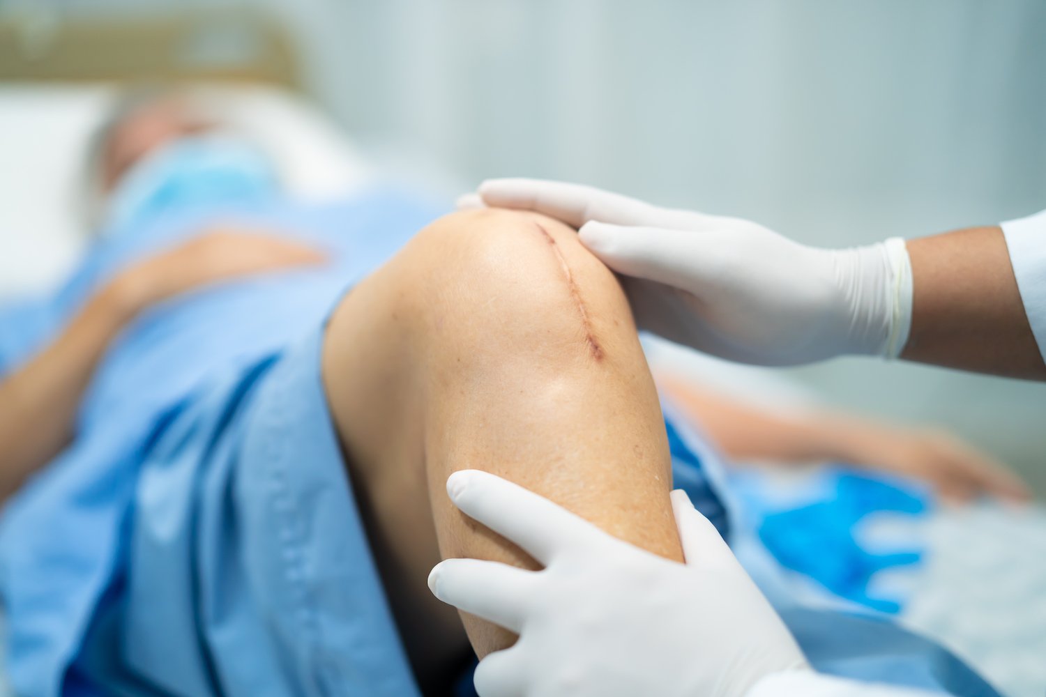 Suture Removal at Home 2 suture-removal-at-home-in-gurgaon